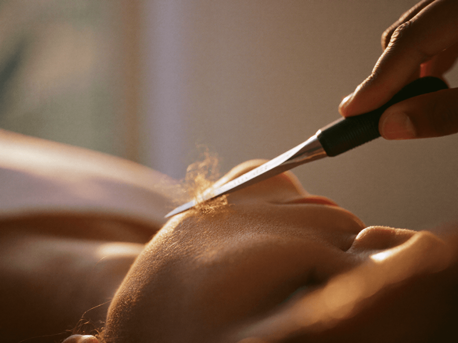 Dermaplaning treatment in progress